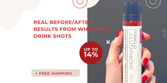 Real before/after results from whitening drink shots